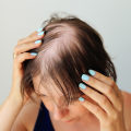 Lifestyle Factors and Female Hair Loss: Understanding the Connection