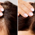 Scalp Treatments for Hair Growth: The Ultimate Guide