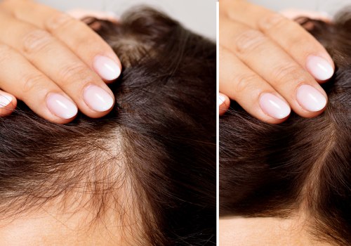 Hair Care Routine for Managing Female Hair Loss