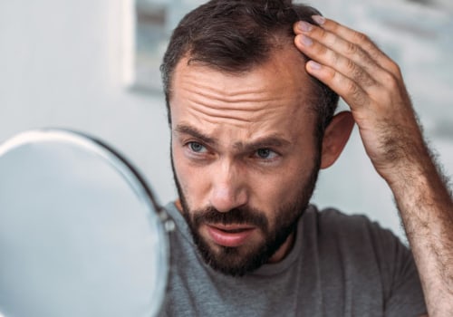 Thyroid Disorders and Hair Loss: Understanding the Link