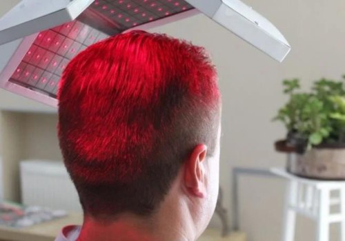 Understanding Low-Level Laser Therapy for Hair Loss